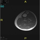 Zoom image: Radiological image