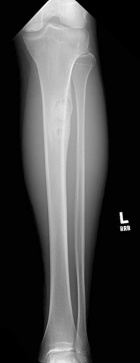 Zoom image: Radiological image