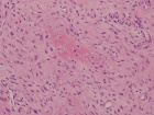 Zoom image: Cell stain