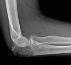 Zoom image: Radiological image