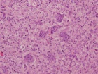 Zoom image: Cell stain