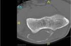 Zoom image: Radiological image