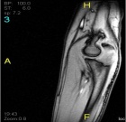 Zoom image: Radiological image