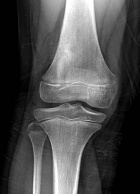 Zoom image: Radiological image