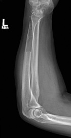 Zoom image: Radiological image