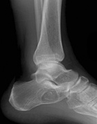 Zoom image: Radiological image