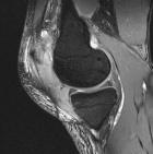 Zoom image: Radiological image