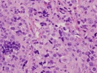 Zoom image: Cell stain