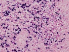 Zoom image: Cell stain