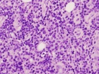 Zoom image: Cell stain