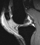 Zoom image: Radiological image