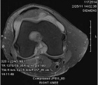 Zoom image: Radiological image