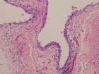 Zoom image: Cell stain