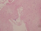 Zoom image: Cell stain