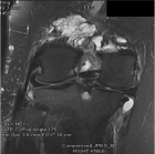 Zoom image: Radiological image