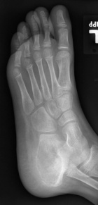 Zoom image: Radiological image