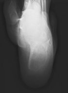 Zoom image: Radiological image