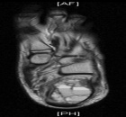 Zoom image: Radiological image