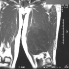 Zoom image: Radiological image
