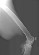 Zoom image: Radiological image