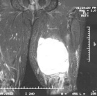 Zoom image: Radiological image