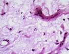 Zoom image: Cell stain