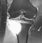 Zoom image: Radiological image