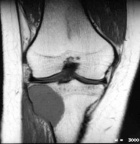 Zoom image: Radiological image