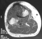 Zoom image: Radiological image