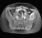 Zoom image: Radiological image