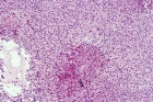 Zoom image: Cell stain