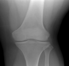 Zoom image: Radiological image