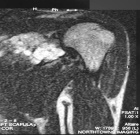 Zoom image: Radiological image