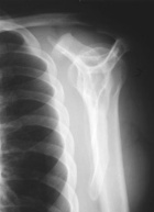 Zoom image: Radiological image