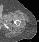 Zoom image: Radiological image