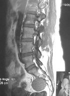 Zoom image: Radiological image