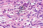 Zoom image: Cell stain