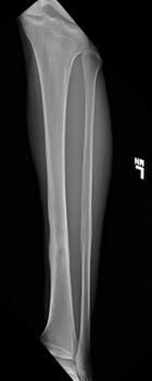 Zoom image: Radiological image