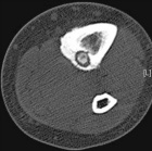 Zoom image: Radiological image