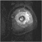 Zoom image: Radiological image