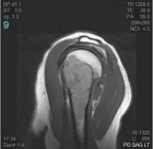 Zoom image: Radiological image