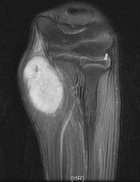 Zoom image: Radiological image