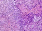 Zoom image: Cell stain