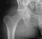 Zoom image: Radiological image