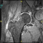 Zoom image: Radiological image
