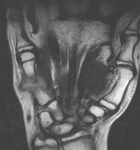 Zoom image: Radiological image