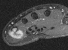 Zoom image: Radiological image
