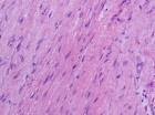 Zoom image: Cell stain