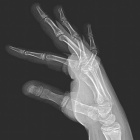 Zoom image: Radiological image