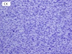 Zoom image: Cell stain